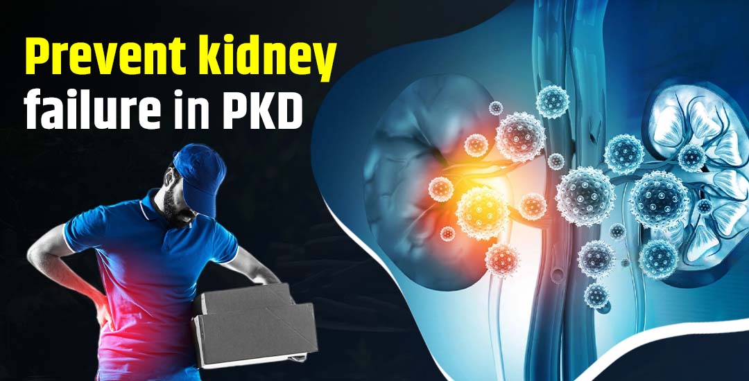 Can You Prevent Kidney Failure If You Have PKD? Here's What Experts Say